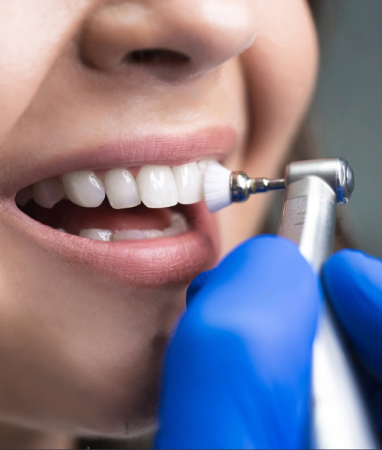 Teeth Whitening Espanola