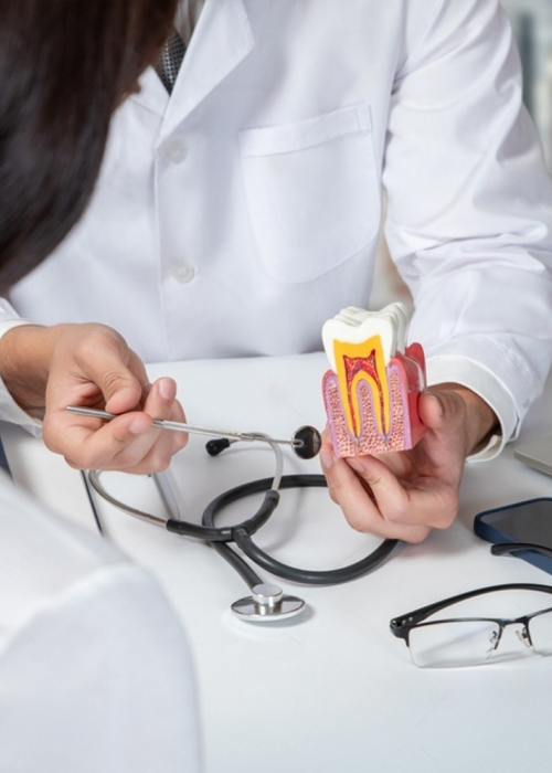 Root Canals Explained