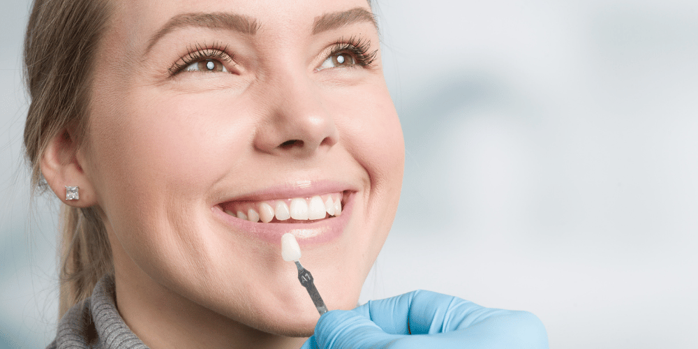 Dental Veneers